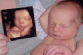 3d ultrasound before and after image ultrasound by (A Baby Visit)